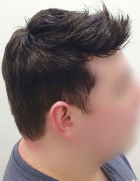 After mens hair systems in liverpool