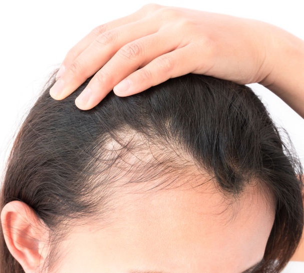 Best hair systems in Liverpool at Hair Transform